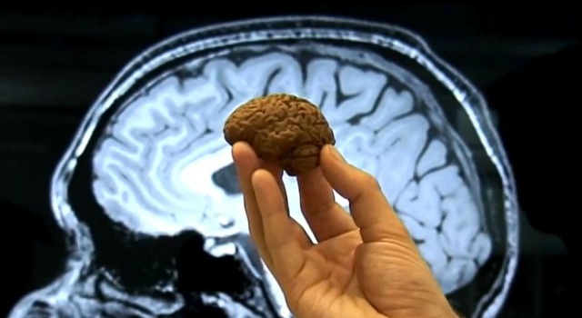 Des chercheurs produisent un mini-cerveau humain presque complet en ...