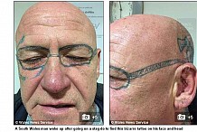 Pays de Galles : Il s'était fait tatouer ses lunettes sur le visage