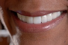 5 façons naturelles de rendre vos dents blanches et brillantes